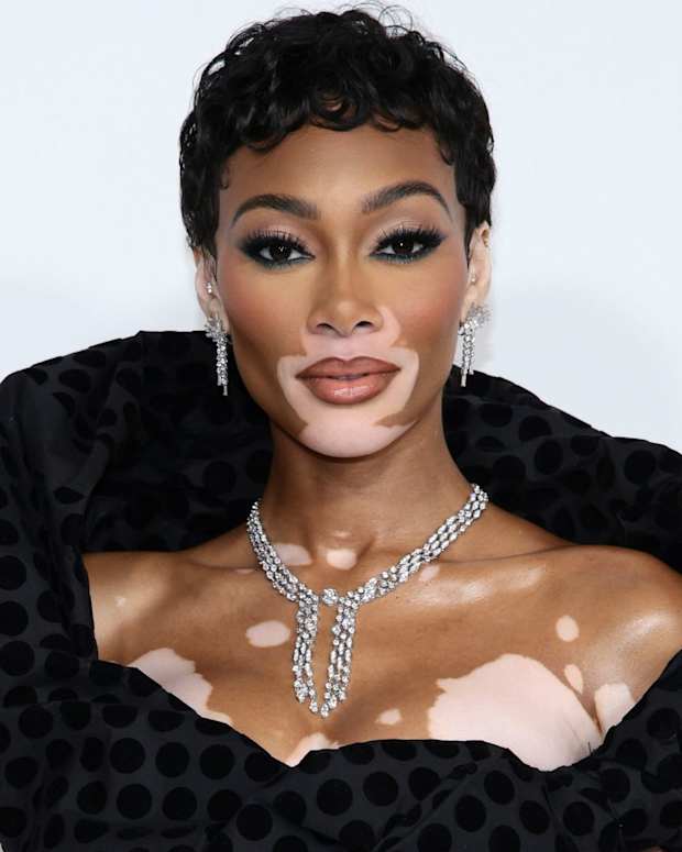Winnie Harlow